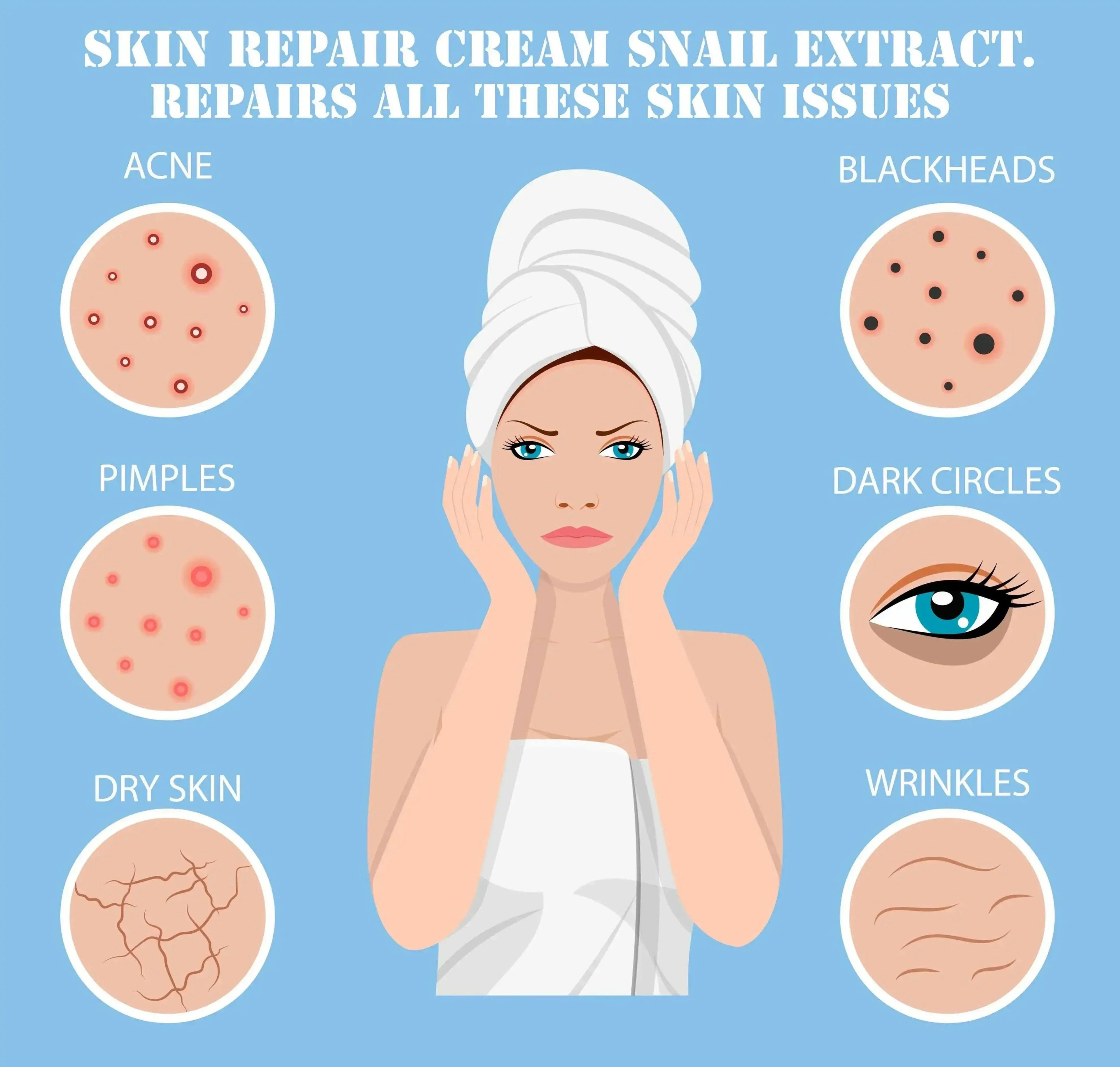 Ammuri Snail Extract Skin Cream for Deep Repair-1